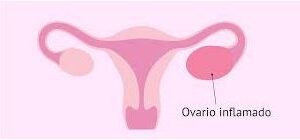 ovario
